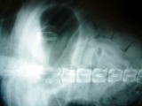 xray